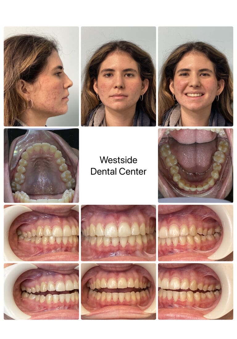 14734197_Lucia_Arroyo_composite (3)